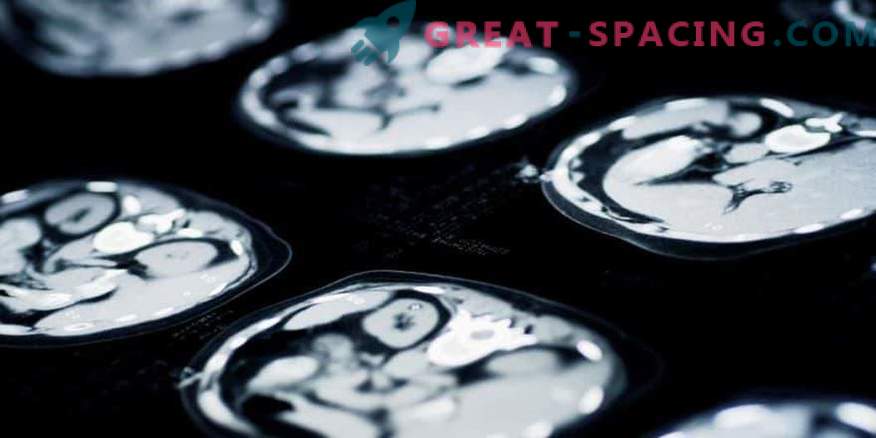 Spaceflight extinde mintea, dar comprimă creierul